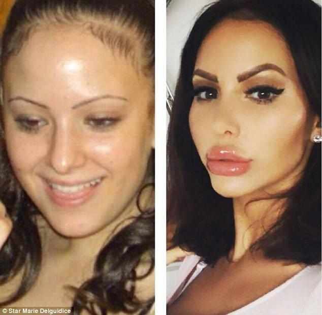 Anasına bənzəməmək üçün 200 əməliyyat keçirdi -  FOTOLAR